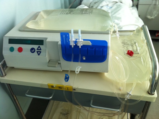 武汉市第一医院-肾一病区开展自动化腹膜透析